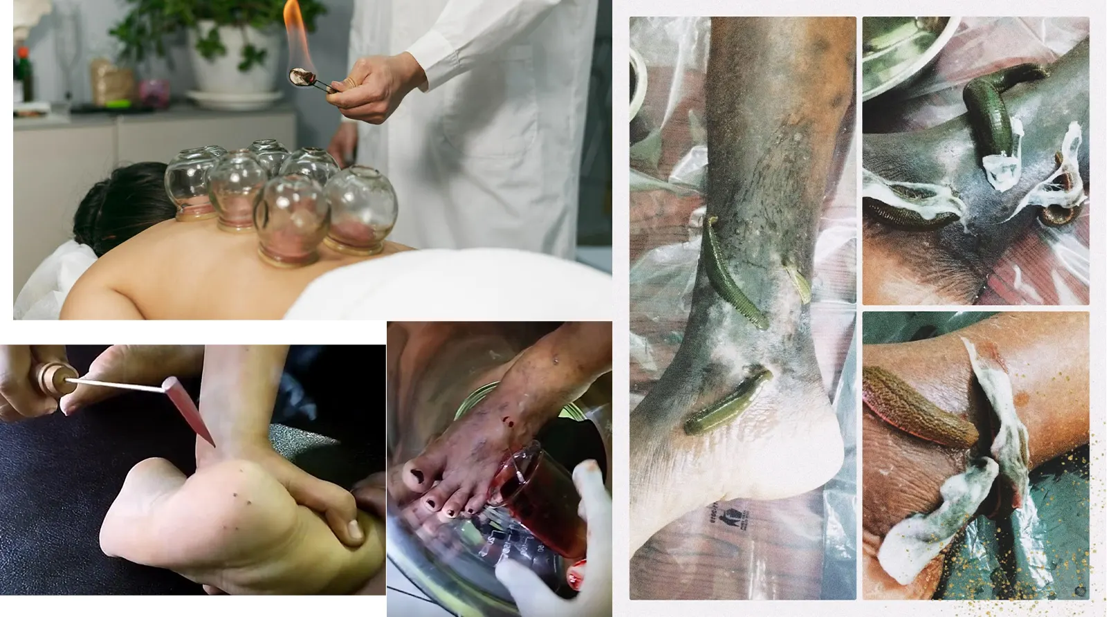 Parasurgical Department